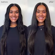 Before/after image