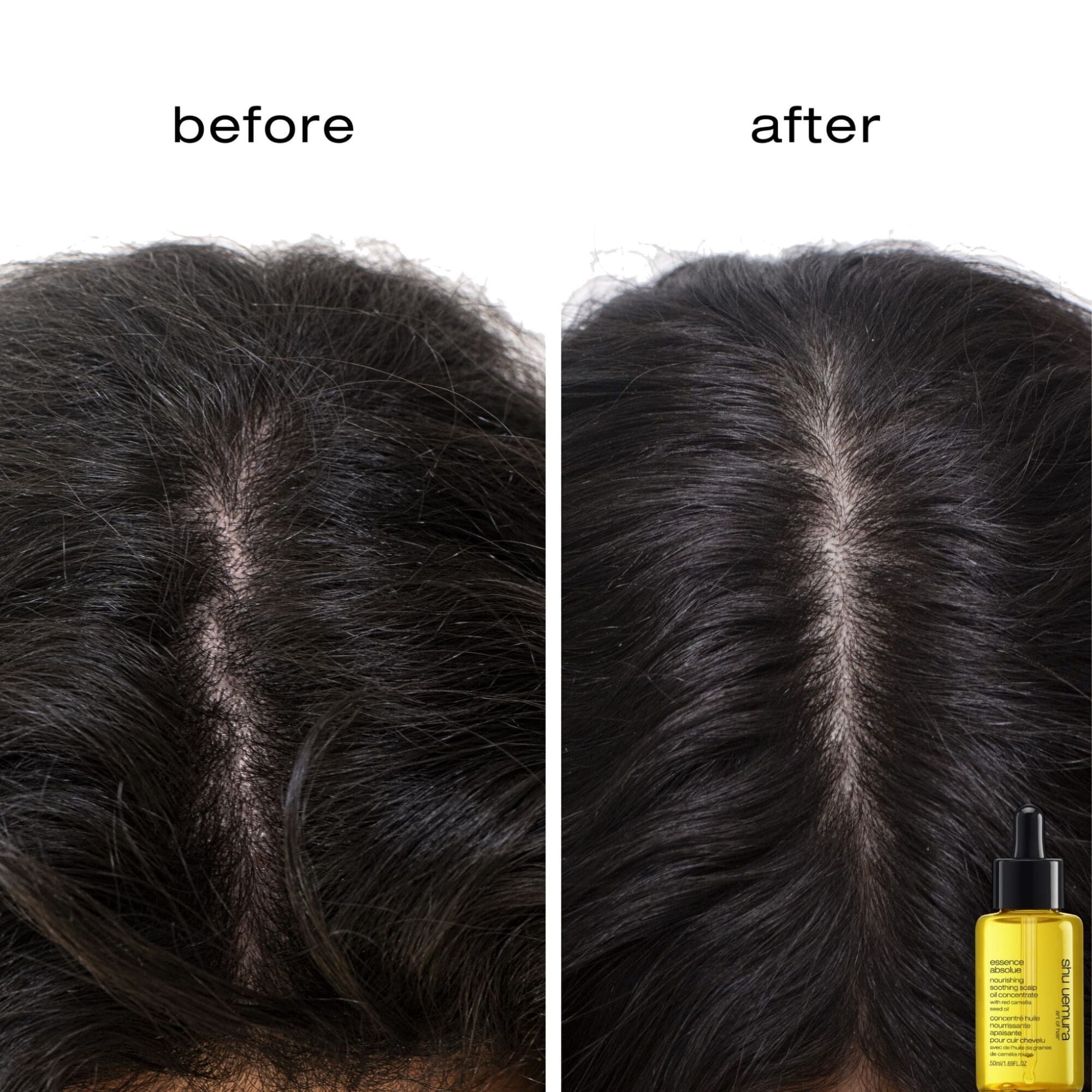 最新人気 essence absolue concentrate oil scalp soothing nourishing リップケア